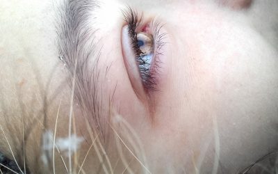 Do You Have Anemia?  Two Types to Be Aware Of